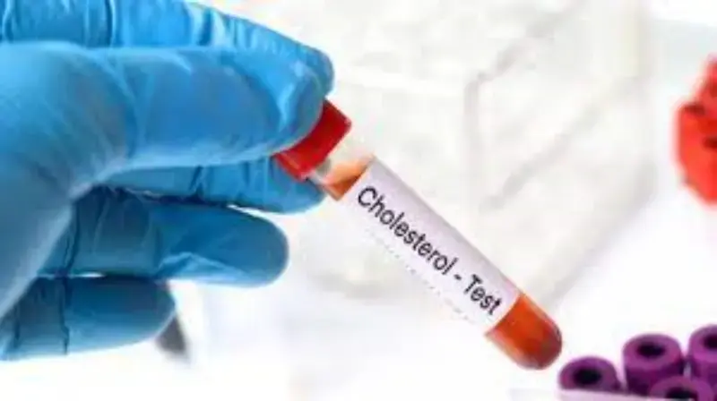 Imagem ilustrativa de Exame colesterol cachorro